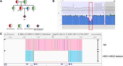 Detection of four rare thalassemia variants using Single-molecule realtime sequencing